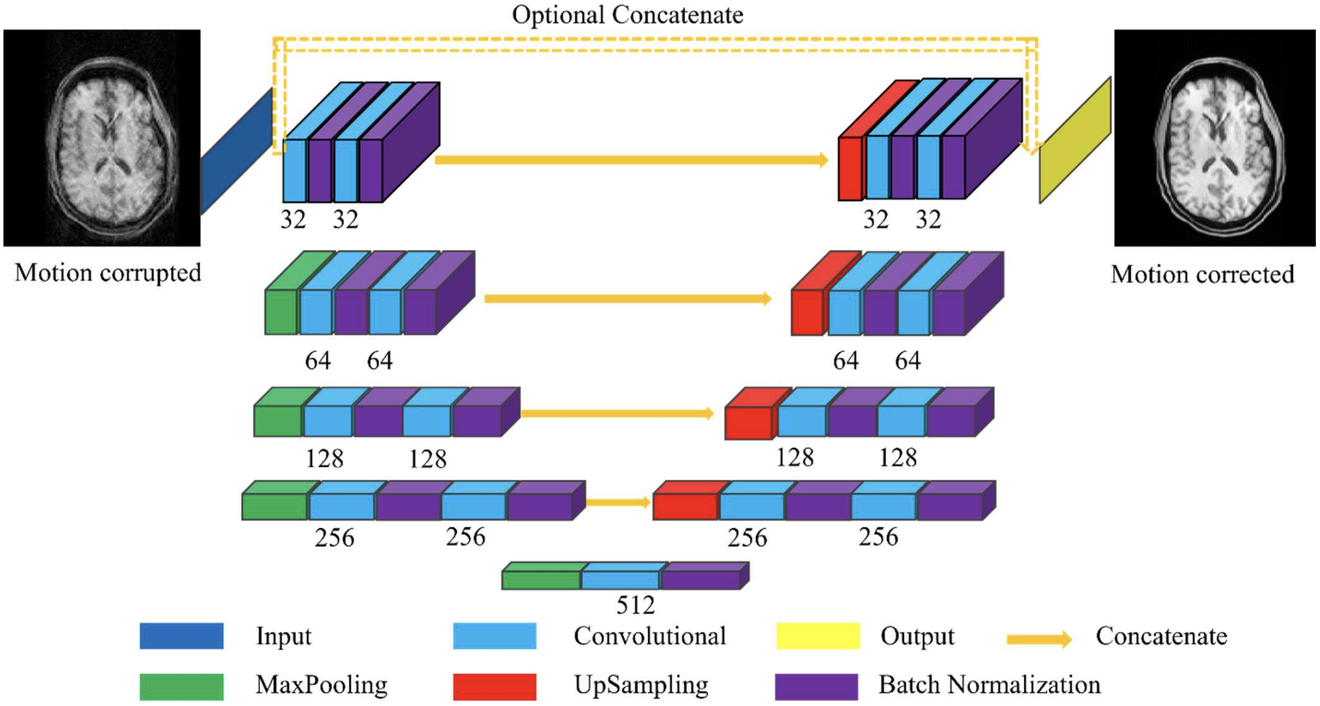 The MC-Net architecture: a motion-corrupted brain MRI slice enters a UNet encoder-decoder with convolutional, max-pooling, upsampling and batch-normalisation stages, producing a motion-corrected slice